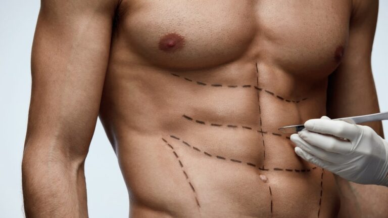 'Six-pack surgery' gaining popularity among men, say plastic surgeons