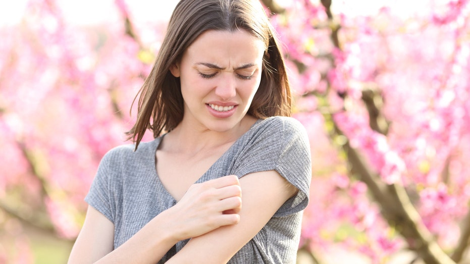 Ask a doctor: ‘How can I prevent scarring from bug bites and poison ivy?’