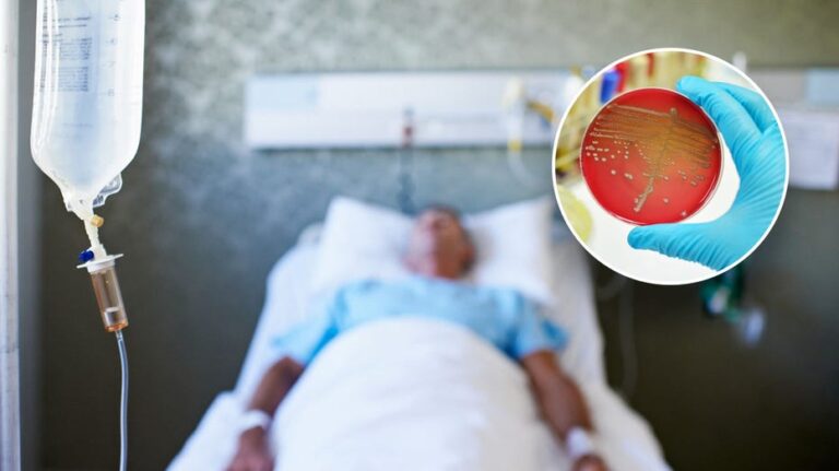 Sepsis a top killer behind heart disease, cancer in US: What to know, how to avoid the condition